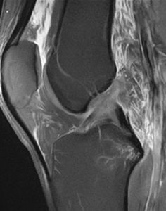 Polven magneettikuva sivulta